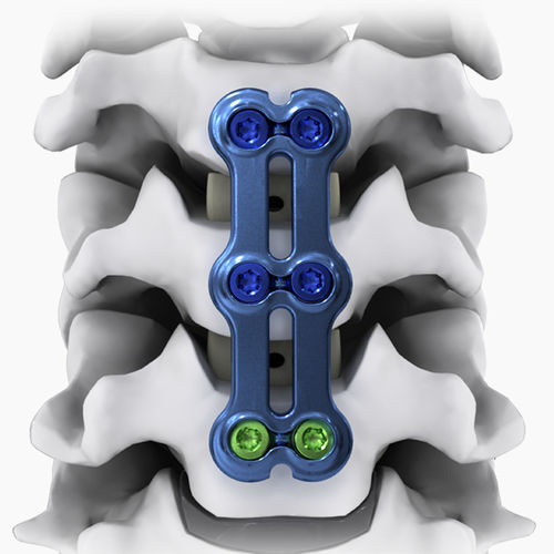 Placca per artrodesi cervicale - NEO®-SL - Life Spine - bloccata / in metallo / 2 livelli