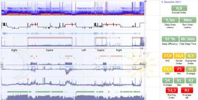 Software per polisonnografia - Noxturnal™ - Nox Medical - di analisi / per reportistica / di registrazione