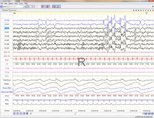 Software di gestione - Crystal PSG™ - CleveMed - per reportistica / di acquisizione / di registrazione
