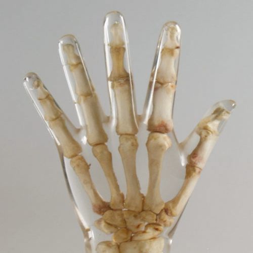 Phantom di calibrazione per radiografia - 12711 - QUART X-Ray QA Solutions - per fluoroscopia / mano