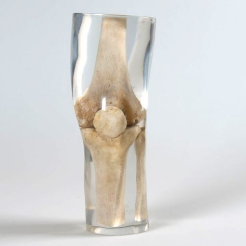 Phantom di calibrazione per radiografia - 12714 - QUART X-Ray QA Solutions - per gamba / per ginocchio / di femore