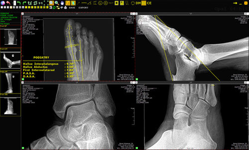 Sistema di trasmissione per diagnostica per immagini - Opal-RAD - 20/20 Imaging - di archiviazione