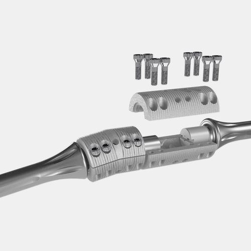 Chiodo intramidollare per femore - OsteoBridge™ - Merete - per tibia / per omero / in titanio
