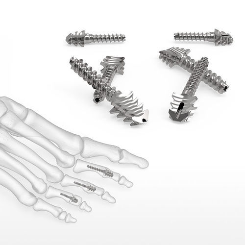 Vite per compressione ossea per articolazione metatarso-falangea - ExtremiFuse™  - Acumed - in metallo