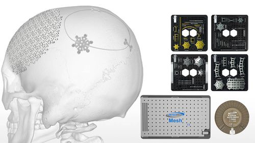 Sistema di fissazione cranica non assorbibile - Fast Flap™ - Acumed
