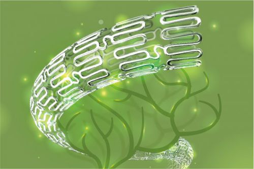 Stent intracranico - NOVA™ - SINOMED - per somministrazione di farmaci