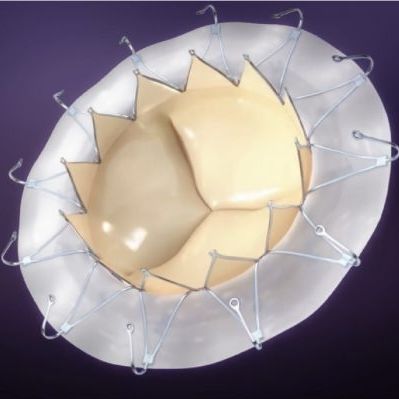 Bioprotesi valvolare mitrale - AccuFit® - SINOMED