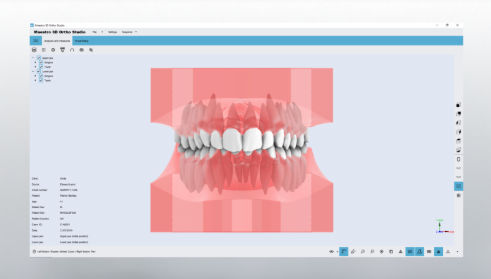 Software CAD - Studio - AGE Solutions - di visualizzazione 3D / ortodontico / per laboratorio dentale