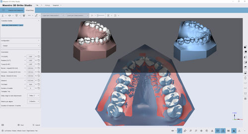 Software di analisi - Ortho Studio - AGE Solutions - di visualizzazione 3D / di misura / di trattamento