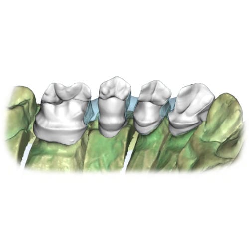 Software odontoiatrico - Restoration - AGE Solutions - da laboratorio / didattico / CAD