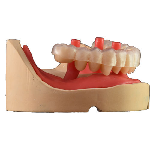 Software di acquisizione - Smile Creator - AGE Solutions - odontoiatrico