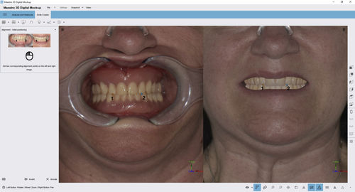 Software diagnostico - Digital Mockup - AGE Solutions - di trattamento / odontoiatrico