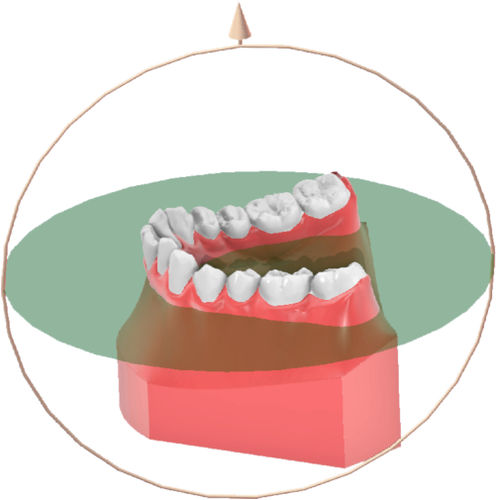 Software ortodontico - Maestro 3D ortho - Shining 3D - odontoiatrico / di analisi / di misura