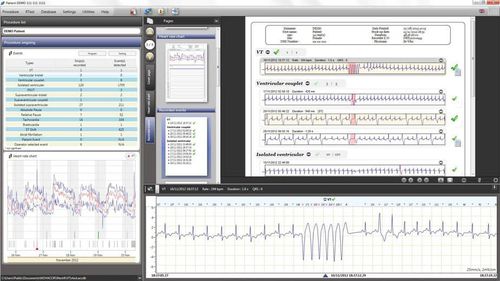 Software clinico - RTSoft Ultima - Novacor - per reportistica / di sicurezza