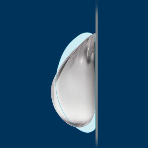 Impianto mammario - TruForm® 1 - Allergan - Natrelle - rotondo / silicone / in gel di silicone