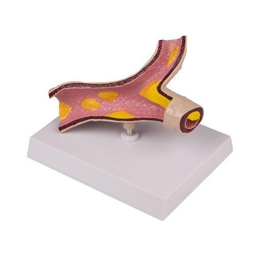 Modello anatomico di arteria - YA/C017 - Yuan Technology - ad uso didattico