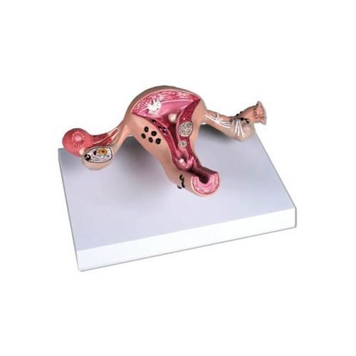 Modello anatomico di utero - YA/U043B - Yuan Technology - ad uso didattico