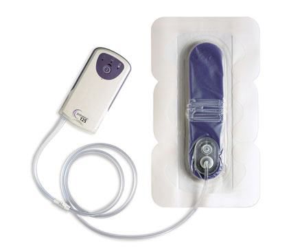 Unità terapeutica a pressione negativa a batteria - Prevena™ - Kinetic Concepts