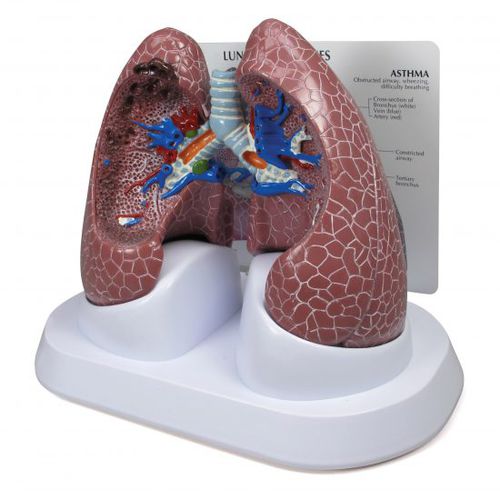 Modello anatomico di polmone - 3110 - GPI Anatomicals - ad uso didattico / oncologico / BPCO