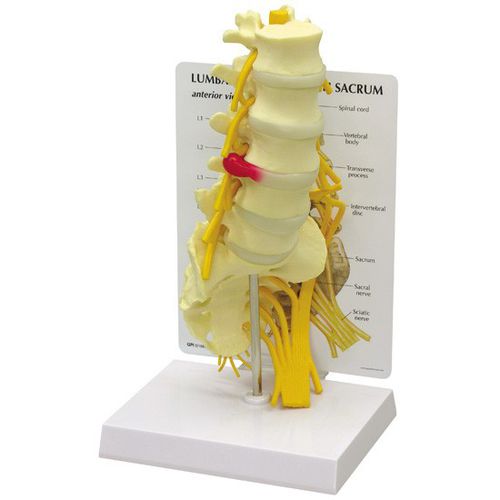 Modello anatomico di vertebre lombari - 1700 - GPI Anatomicals - ad uso didattico
