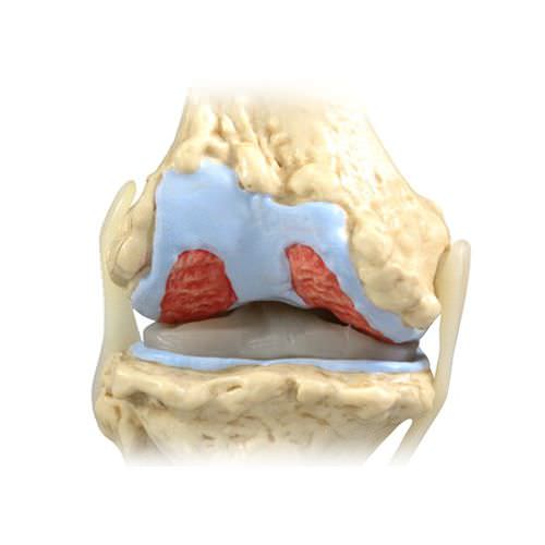 Modello anatomico di articolazione - 1100 - GPI Anatomicals - per ginocchio / ad uso didattico