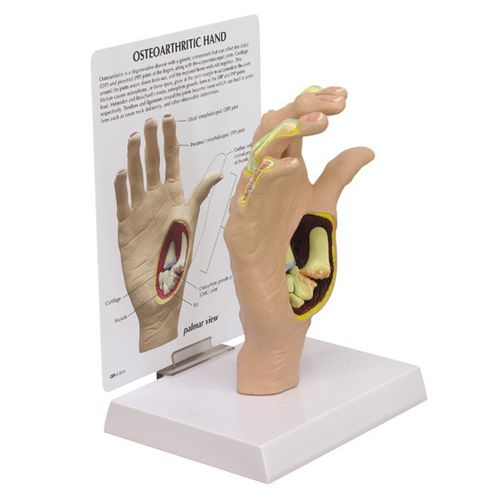 Modello anatomico osseo - 1930 - GPI Anatomicals - di articolazione / di mano / ad uso didattico