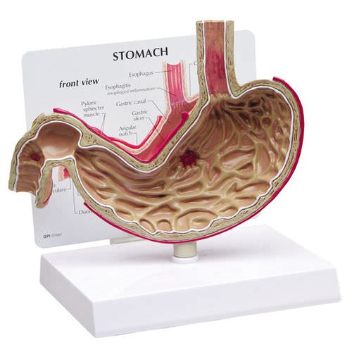 Modello anatomico di stomaco - 2000 - GPI Anatomicals - duodenale / esofageo / ad uso didattico