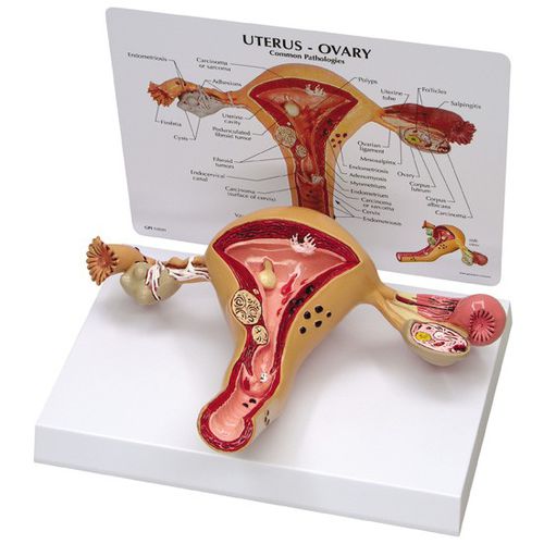 Modello anatomico di utero - 3480 - GPI Anatomicals - di ovaia / ad uso didattico / femminile
