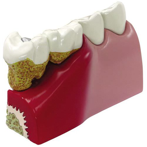 Modello anatomico di denti - 2860 - GPI Anatomicals - odontoiatrico / ad uso didattico