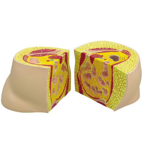 Modello anatomico di anca - 3600 - GPI Anatomicals - ad uso didattico / per obesità / bariatrico