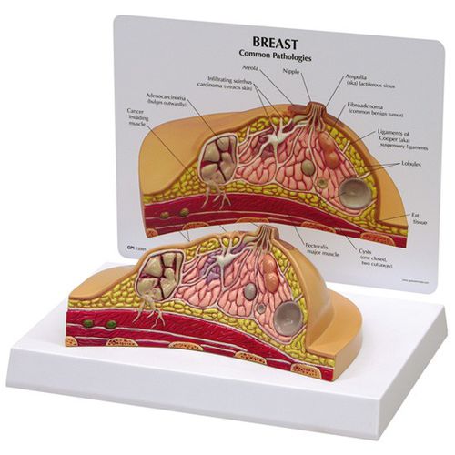 Modello anatomico di seno - 3450 - GPI Anatomicals - ad uso didattico / oncologico / femminile