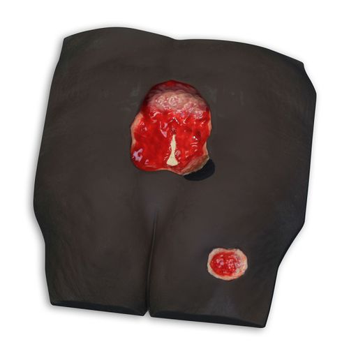 Modello anatomico osseo - Stan™  - VATA, Inc. - lombo-sacrale / di pelle / di trattamento delle piaghe da decubito