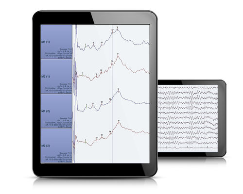 Software di analisi - AlphaView - Dr. Grossegger & Drbal alpha trace medical systems - per EEG / per polisonnografia / Windows