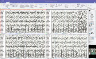 Software medico - Profusion™ - Dr. Grossegger & Drbal alpha trace medical systems - per EEG / di gestione dati / di monitoraggio