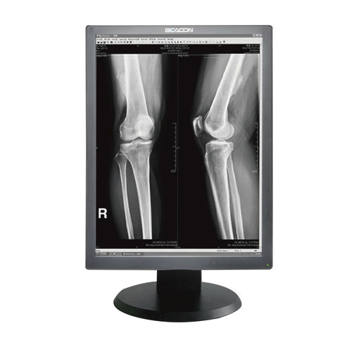 Monitor medico - G23S+ - Shenzhen Beacon Display Technology - diagnostico / ad alta definizione / 21.3"