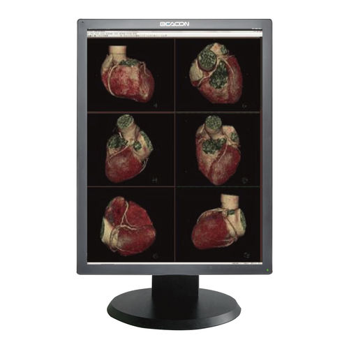 Monitor medico - C310S - Shenzhen Beacon Display Technology - per diagnostica per immagini / diagnostico / ad alta definizione