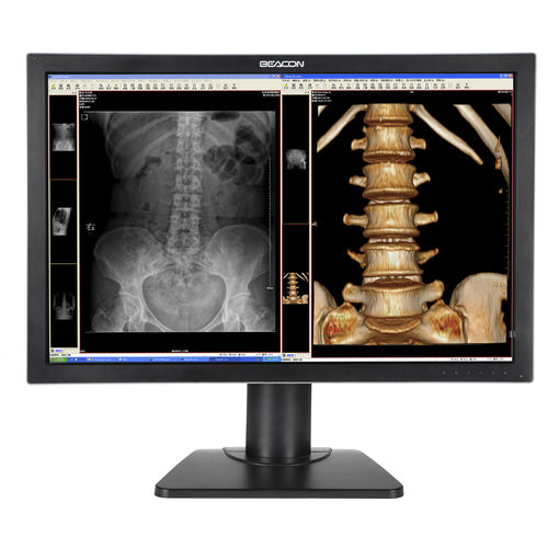 Monitor medico - C44W+ - Shenzhen Beacon Display Technology - diagnostico / ad alta definizione / 30"