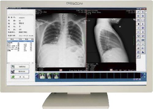 Monitor medico - C22W - Shenzhen Beacon Display Technology - 1920 x 1080 / 21,5" / LED