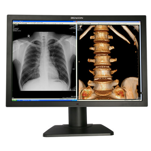 Monitor medico - C82W+ - Shenzhen Beacon Display Technology - diagnostico / Full HD / 3840 × 2160