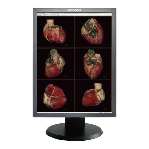 Monitor medico - C24S+ - Shenzhen Beacon Display Technology - per diagnostica per immagini / diagnostico / ad alta definizione