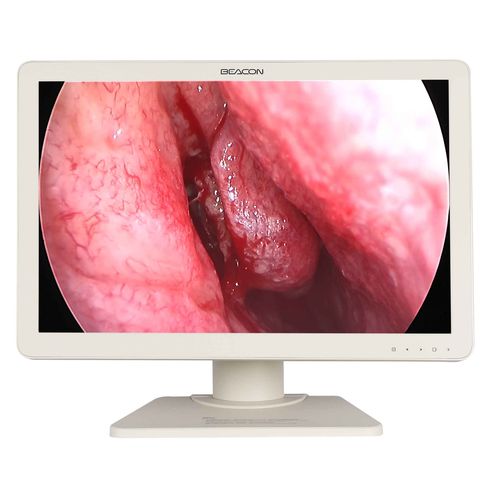 Monitor medico - E2421 - Shenzhen Beacon Display Technology - per sala operatoria / per endoscopia / Full HD