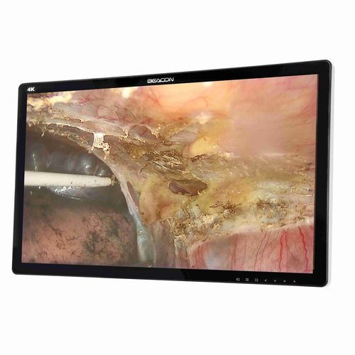Monitor medico - S2785P - Shenzhen Beacon Display Technology - chirurgico / 4K / 27"