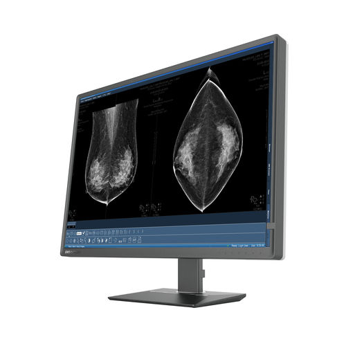 Monitor medico - C1216W - Shenzhen Beacon Display Technology - per mammografia / per radiologia / ad alta definizione