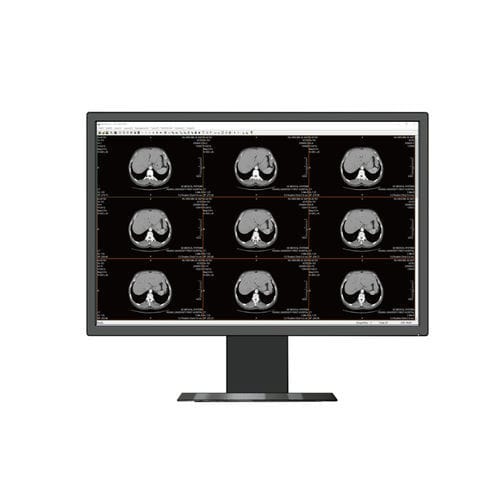 Monitor medico - HL2416SH - Shenzhen Beacon Display Technology - per radiologia / ad alta definizione / 24"