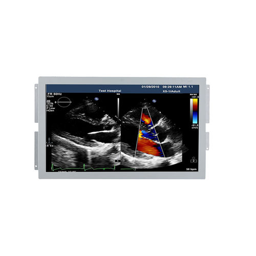 Monitor medico - U238W - Shenzhen Beacon Display Technology - per ecografia / 1920 x 1080 / 23,8"