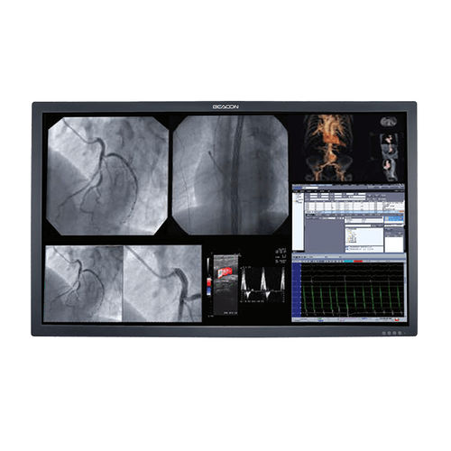 Monitor medico - S556P - Shenzhen Beacon Display Technology - 3840 × 2160 / 55" / ad alta luminosità