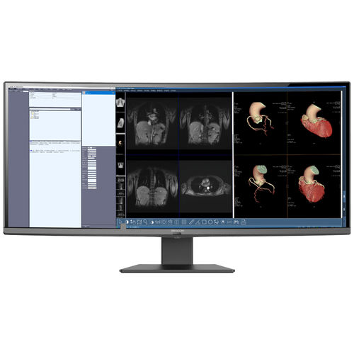 Monitor medico - C610W - Shenzhen Beacon Display Technology - ad alta definizione / ad alta luminosità / HDMI