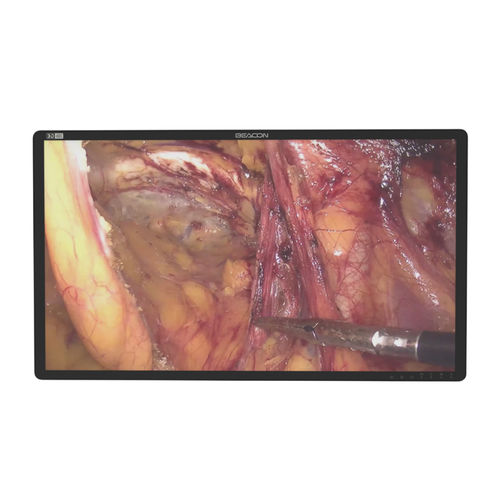 Monitor medico - S3285P-3D - Shenzhen Beacon Display Technology - per sala operatoria / per endoscopia / chirurgico