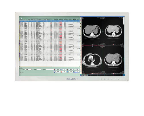 Monitor medico - HL2416SHT - Shenzhen Beacon Display Technology - ad alta definizione / 24" / LED