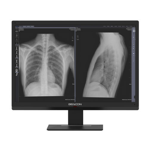 Monitor medico - C616W - Shenzhen Beacon Display Technology - ad alta definizione / 30" / ad alta luminosità